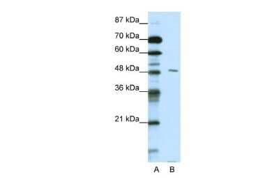 Western Blot: PBX2 Antibody [NBP2-85445] - WB Suggested Anti-PBX2 Antibody Titration: 0.2-1 ug/ml. ELISA Titer: 1:312500. Positive Control: HepG2 cell lysateThere is BioGPS gene expression data showing that PBX2 is expressed in HepG2