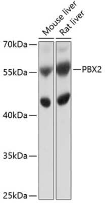 Western Blot: PBX2 Antibody [NBP2-93346] - Analysis of extracts of various cell lines, using PBX2 at 1:1000 dilution.Secondary antibody: HRP Goat Anti-Rabbit IgG (H+L) at 1:10000 dilution.Lysates/proteins: 25ug per lane.Blocking buffer: 3% nonfat dry milk in TBST.Detection: ECL Basic Kit .Exposure time: 5s.