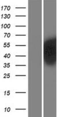 Western Blot: PBX2 Overexpression Lysate (Adult Normal) [NBP2-08093] Left-Empty vector transfected control cell lysate (HEK293 cell lysate); Right -Over-expression Lysate for PBX2.