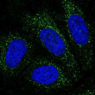 Immunocytochemistry/Immunofluorescence: PBX4 Antibody [NBP2-76550] - Staining of human cell line HeLa shows localization to vesicles. Antibody staining is shown in green.