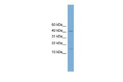 Western Blot: PBX4 Antibody [NBP2-88015] - WB Suggested Anti-Pbx4 Antibody Titration: 0.2-1 ug/ml. Positive Control: Mouse Small Intestine