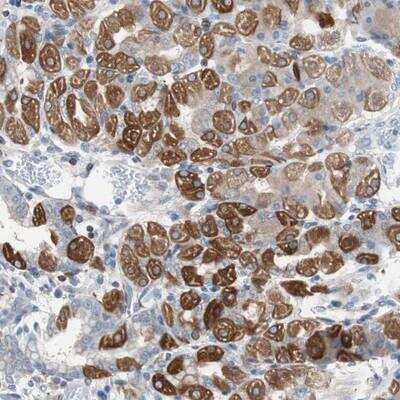 Immunohistochemistry-Paraffin: PBXIP1 Antibody [NBP1-83222] - Staining of human stomach shows strong cytoplasmic positivity in parietal cells.