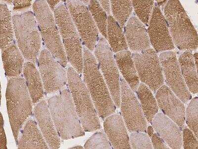 Immunohistochemistry-Paraffin: PBXIP1 Antibody [NBP3-05982] - Staining of human PBXIP1 in human skeletal muscle with rabbit polyclonal antibody at 1:2000 dilution.