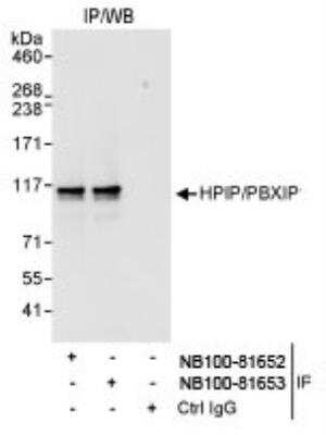 Immunoprecipitation: PBXIP1 Antibody [NB100-81653] - Detection of Human HPIP/PBXIP1 by Western Blot of  Immunoprecipitates. Samples: Whole cell lysate (1 mg for IP,  20% of IP loaded) from HeLa cells. Antibodies: Affinity purified  rabbit anti-HPIP/PBXIP1 antibody NB100-81653 used for IP at 3  mcg/mg lysate. HPIP/PBXIP1 was also immunoprecipitated by  rabbit anti-HPIP/PBXIP1 antibody NB100-81652, which  recognizes an upstream epitope. Detection: Chemiluminescence with an exposure  time of 10 seconds.