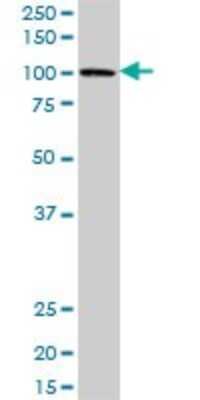 Western Blot: PBXIP1 Antibody [H00057326-B01P] - Analysis of PBXIP1 expression in A-431.