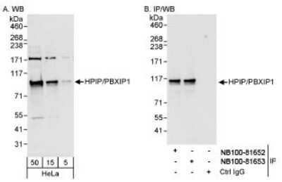 Western Blot: PBXIP1 Antibody [NB100-81652] - Detection of Human HPIP/PBXIP1 on HeLa whole cell lysate using NB100-81652. HPIP/PBXIP1 was also immunoprecipitated by rabbit anti-HPIP/PBXIP1 antibody NB100-81653.