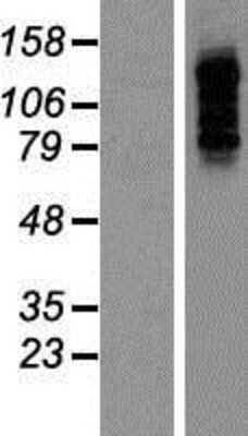 Western Blot: PBXIP1 Overexpression Lysate (Adult Normal) [NBP2-06635] Left-Empty vector transfected control cell lysate (HEK293 cell lysate); Right -Over-expression Lysate for PBXIP1.
