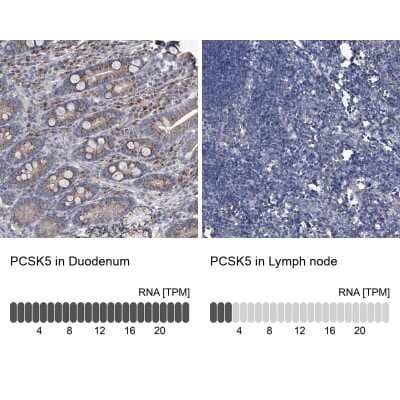 Immunohistochemistry-Paraffin: PC6 Antibody [NBP1-87326] - Staining in human duodenum and lymph node tissues using anti-PCSK5 antibody. Corresponding PCSK5 RNA-seq data are presented for the same tissues.