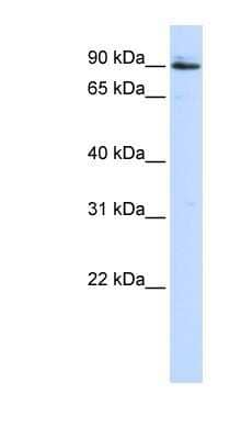 Western Blot: PC6 Antibody [NBP1-57908] - 293T cells lysate, concentration 0.2-1 ug/ml.