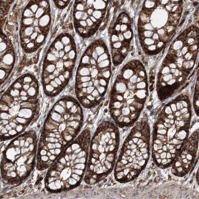 Immunohistochemistry-Paraffin: PCBD2 Antibody [NBP1-85281] - Staining of human colon shows strong cytoplasmic and membrane positivity in glandular cells.