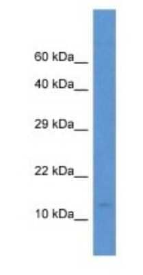 Western Blot: PCBD2 Antibody [NBP1-74264] - Human Fetal Small Intestine Cell Lysate, concentration 1 ug/ml.