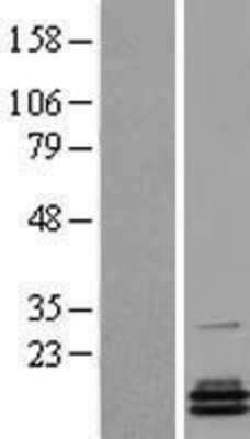 Western Blot: PCBD2 Overexpression Lysate (Adult Normal) [NBL1-14141] Left-Empty vector transfected control cell lysate (HEK293 cell lysate); Right -Over-expression Lysate for PCBD2.