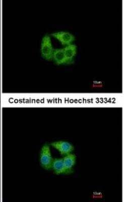 Immunocytochemistry/Immunofluorescence: PCCB Antibody [NBP1-31464] - Analysis of methanol-fixed Hep G2, using antibody at 1:500 dilution.