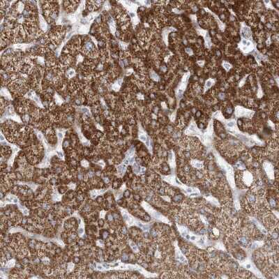 Immunohistochemistry-Paraffin: PCCB Antibody [NBP1-85887] - Staining of human liver shows strong cytoplasmic positivity in hepatocytes.