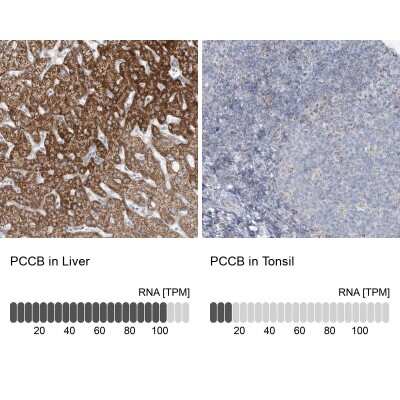 <b>Orthogonal Strategies Validation. </b>Immunohistochemistry-Paraffin: PCCB Antibody [NBP1-85887] - Staining in human liver and tonsil tissues using anti-PCCB antibody. Corresponding PCCB RNA-seq data are presented for the same tissues.