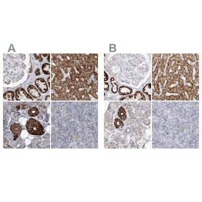 <b>Independent Antibodies Validation. </b>Immunohistochemistry-Paraffin: PCCB Antibody [NBP1-85887] - Staining of human kidney, liver, salivary gland and tonsil using Anti-PCCB antibody NBP1-85887 (A) shows similar protein distribution across tissues to independent antibody NBP1-85886 (B).