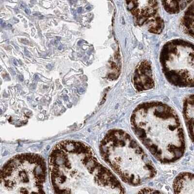 Immunohistochemistry-Paraffin: PCCB Antibody [NBP1-85887] - Staining of human kidney.