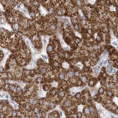 Immunohistochemistry-Paraffin: PCCB Antibody [NBP1-85887] - Staining of human liver using Anti-PCCB antibody NBP1-85887.