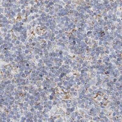 <b>Independent Antibodies Validation. </b>Immunohistochemistry-Paraffin: PCCB Antibody [NBP1-85887] - Staining of human tonsil using Anti-PCCB antibody NBP1-85887.