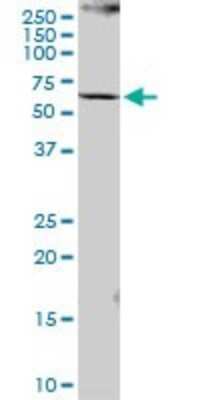 Western Blot: PCCB Antibody [H00005096-B01P] - Analysis of PCCB expression in HeLa.