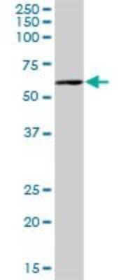 Western Blot: PCCB Antibody [H00005096-B01P] - Analysis of PCCB expression in human liver.