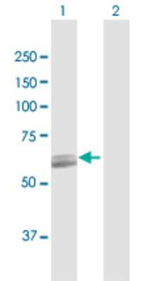 Western Blot: PCCB Antibody [H00005096-D01P] - Analysis of PCCB expression in transfected 293T cell line by PCCB polyclonal antibody.Lane 1: PCCB transfected lysate(58.20 KDa).Lane 2: Non-transfected lysate.