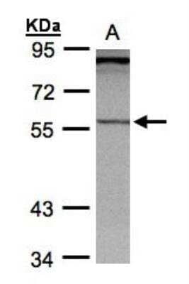 Western Blot: PCCB Antibody [NBP1-31464] - Sample (30 ug whole cell lysate) A: HepG2 7.5% SDS PAGE diluted at 1:1000 The HRP-conjugated anti-rabbit IgG antibody (NBP2-19301) was used to detect the primary antibody.