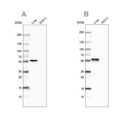 Western Blot: PCCB Antibody [NBP1-85887] - Analysis using Anti-PCCB antibody NBP1-85887 (A) shows similar pattern to independent antibody NBP1-85886 (B).