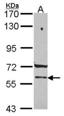 Western Blot: PCCB Antibody [NBP2-19718] - Sample (30 ug of whole cell lysate) A: 293T 7. 5% SDS PAGE gel, diluted at 1:1000.