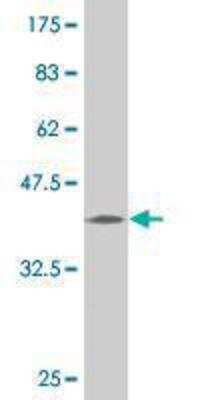 Western Blot: PCDH1 Antibody (2A11) [H00005097-M05] - detection against Immunogen (37.99 KDa) .