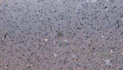 Immunohistochemistry-Paraffin PCDH11 Antibody