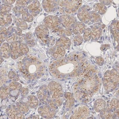 Immunohistochemistry-Paraffin PCDH11 Antibody - BSA Free