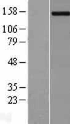 Western Blot: PCDH11Y Overexpression Lysate (Adult Normal) [NBL1-14149] Left-Empty vector transfected control cell lysate (HEK293 cell lysate); Right -Over-expression Lysate for PCDH11Y.