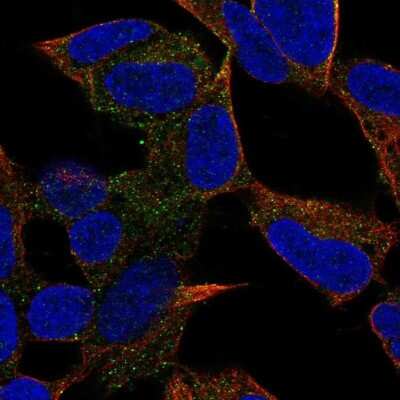 Immunocytochemistry/Immunofluorescence: PCDH20 Antibody [NBP2-68793] - Staining of human cell line SH-SY5Y shows localization to vesicles.