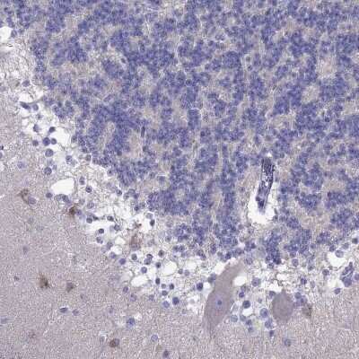 Immunohistochemistry: PCDHA6 Antibody [NBP2-69060] - Immunohistochemical staining of human cerebellum shows moderate cytoplasmic positivity in cells in molecular layer.