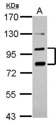 Western Blot: PCDHA6 Antibody [NBP2-19725] - Sample (30 ug of whole cell lysate) A: PC-3 7. 5% SDS PAGE gel, diluted at 1:1000.