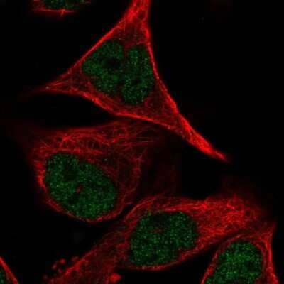 Immunocytochemistry/Immunofluorescence: PCDHB2 Antibody [NBP2-30922] - Immunofluorescent staining of human cell line RH-30 shows localization to nucleoplasm.