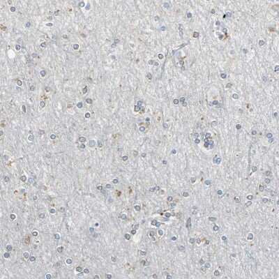 Immunohistochemistry-Paraffin PCDHB2 Antibody