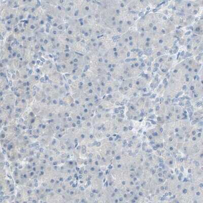 Immunohistochemistry-Paraffin PCDHB2 Antibody