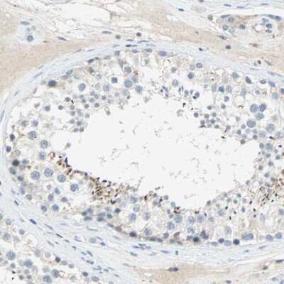 Immunohistochemistry-Paraffin PCDHB2 Antibody