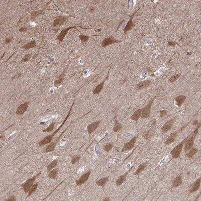 Immunohistochemistry-Paraffin: PCDHB7 Antibody [NBP2-31760] - Staining of human hippocampus shows strong cytoplasmic and nuclear positivity in neuronal cells.