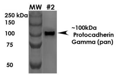 Western Blot: PCDHGA1 Antibody (S159-5) - Pan Specific [NBP2-42207] - analysis of Rat Brain Membrane showing detection of 100 kDa Protocadherin Gamma protein using Mouse Anti-Protocadherin Gamma Monoclonal Antibody, Clone S159-5 . Load: 10 ug. Primary Antibody: Mouse Anti-Protocadherin Gamma Monoclonal Antibody at 1:1000 for 1 hour at RT. Secondary Antibody: Goat Anti-Mouse HRP at 1:200 for 1 hour at RT. Predicted/Observed Size: 100 kDa.