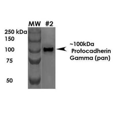 Western Blot: PCDHGA1 Antibody (S159-5) - Pan Specific [NBP2-42207] - Western Blot analysis of Rat Brain Membrane showing detection of ~100 kDa PCDHGA1 protein using Mouse Anti-PCDHGA1 Monoclonal Antibody, Clone S159-5 (NBP2-42207). Load: 10 ug. Primary Antibody: Mouse Anti-PCDHGA1 Monoclonal Antibody (NBP2-42207) at 1:1000 for 1 hour at RT. Secondary Antibody: Goat Anti-Mouse HRP at 1:200 for 1 hour at RT. Predicted/Observed Size: ~100 kDa.