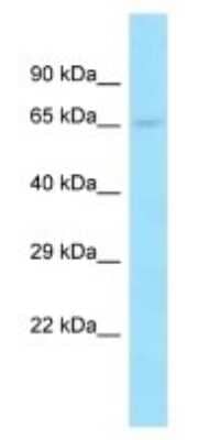 Western Blot: PCDP1 Antibody [NBP3-09303] - Western blot analysis of PCDP1 in Human Hela Whole Cell. Antibody dilution at 1ug/ml