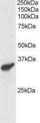 Western Blot: PCGF3 Antibody [NB100-1171] - (1ug/ml) of Human Heart lysate (RIPA buffer, 30ug total protein per lane). Primary incubated for 1 hour. Detected by western blot using chemiluminescence.