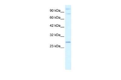 Western Blot: PCGF3 Antibody [NBP2-88019] - WB Suggested Anti-PCGF3 Antibody Titration: 2.5ug/ml. ELISA Titer: 1:62500. Positive Control: Human brain