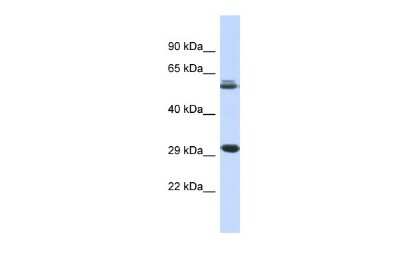 Western Blot: PCGF3 Antibody [NBP2-88020] - Host: Rabbit. Target Name: PCGF3. Sample Type: Fetal Muscle lysates. Antibody Dilution: 1.0ug/ml