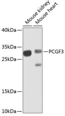 Western Blot: PCGF3 Antibody [NBP2-93613] - Analysis of extracts of various cell lines, using PCGF3 antibody at 1:1000 dilution.Secondary antibody: HRP Goat Anti-Rabbit IgG (H+L)  at 1:10000 dilution.Lysates/proteins: 25ug per lane._Blocking buffer: 3% nonfat dry milk in TBST. Detection: ECL Enhanced Kit.  Exposure time: 30s.