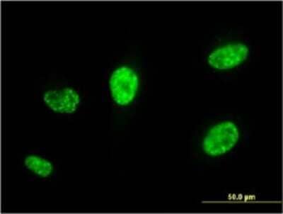 Immunocytochemistry/Immunofluorescence: PCGF5 Antibody (3C10) [H00084333-M01] - Analysis of monoclonal antibody to PCGF5 on HeLa cell . Antibody concentration 10 ug/ml.