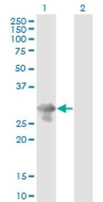 Western Blot PCGF5 Antibody (3C10)